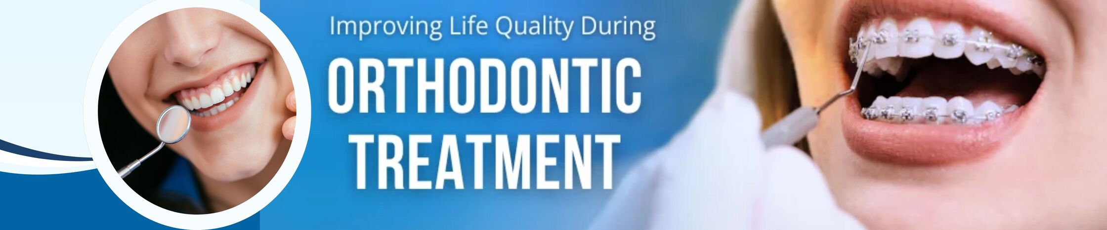 How Orthodontic Treatment Helps You Lead a Better Life: A Comprehensive Guide