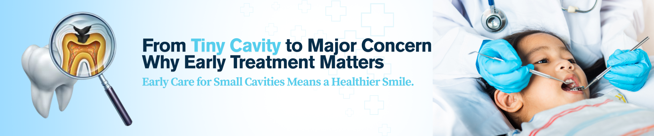 How Small Dental Cavities Can Turn Into Major Oral Health Issues If Left Untreated