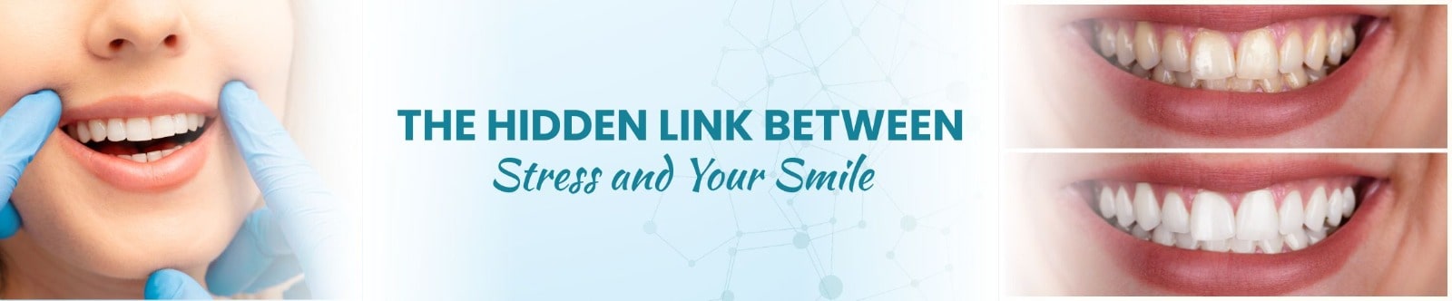 How Stress Affects Your Smile: The Hidden Link Between Stress and Oral Health