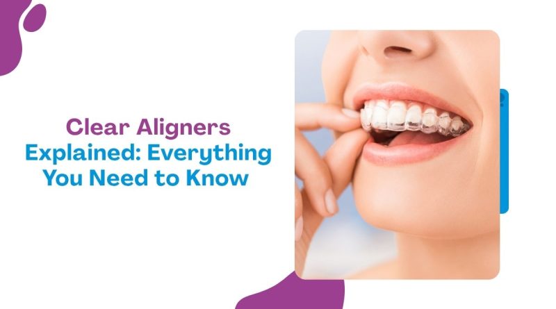 Clear Aligners Explained: Everything You Need to Know About Invisible Braces