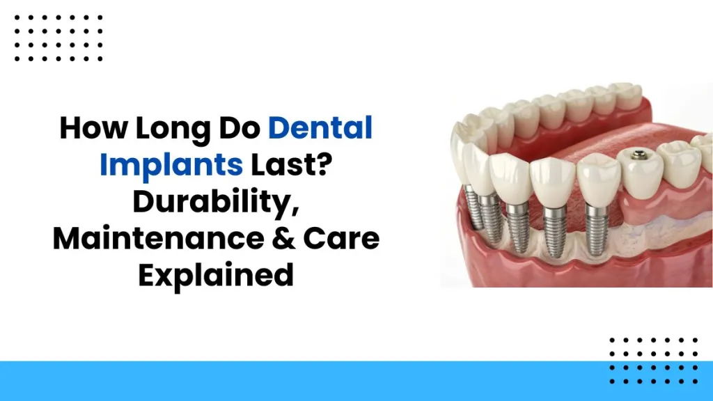 How Long Do Dental Implants Last? Durability, Maintenance & Care Explained
