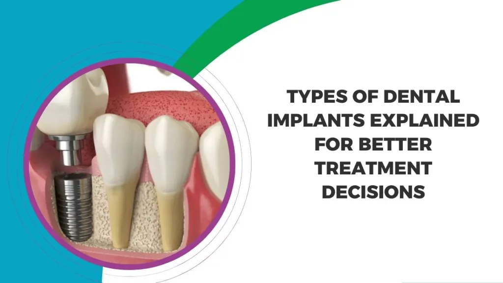 Types of Dental Implants: Understanding Options for Different Dental Needs