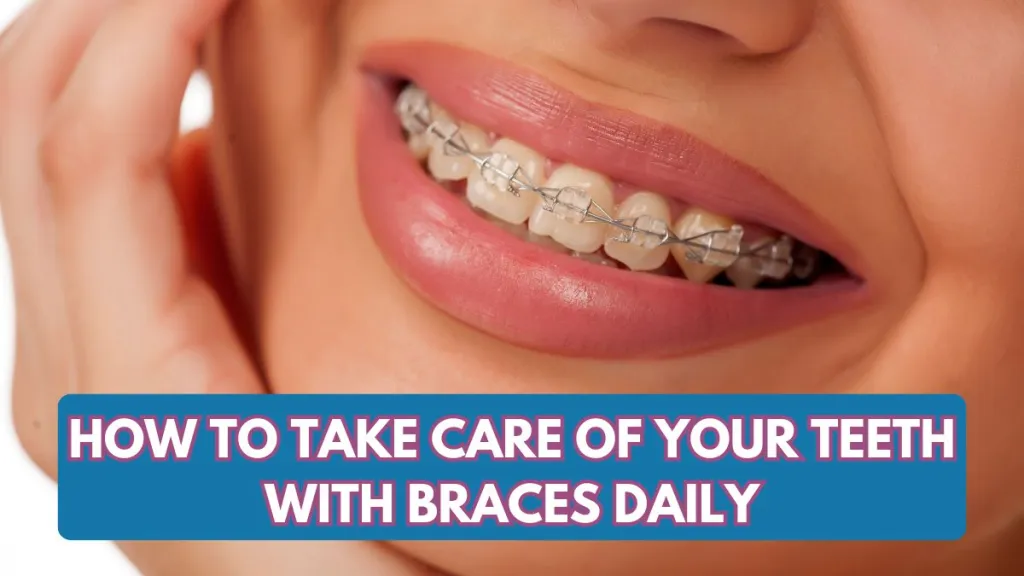 How to Take Care of Your Teeth with Braces Daily