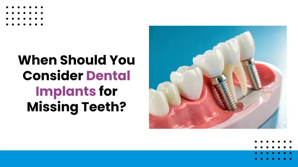 When Should You Consider Dental Implants for Missing Teeth?