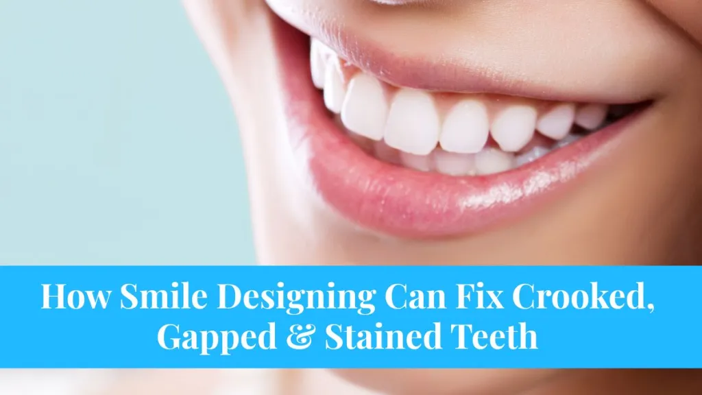 How Smile Designing Can Fix Crooked, Gapped & Stained Teeth