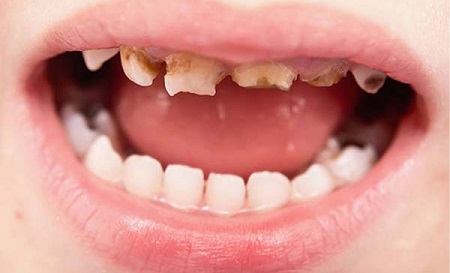 Pediatric Dentistry Solutions