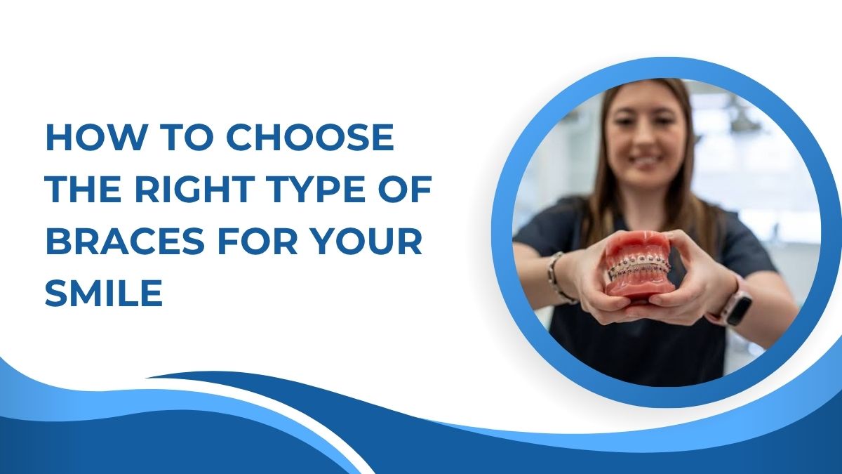 How to Choose the Right Type of Braces for Your Smile