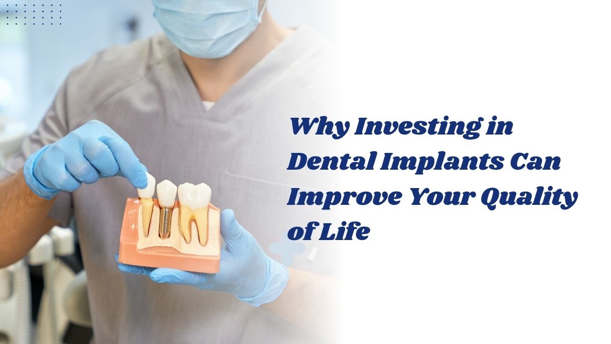 Dental Implants