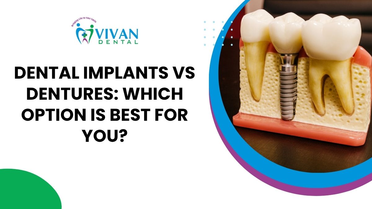 Dental Implants vs Dentures: Which Option Is Best for You?